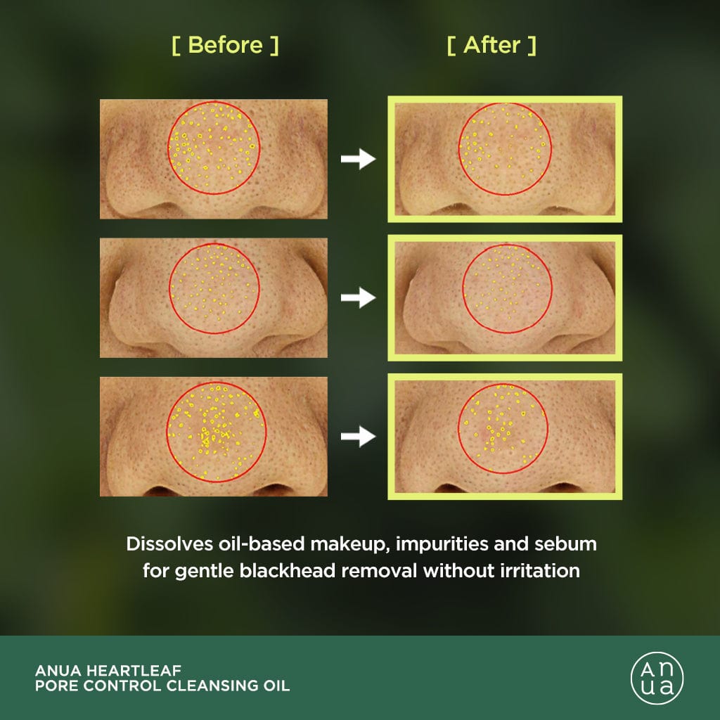 HEARTLEAF PORE CONTROL CLEANSING OIL | ANUA غسول زيتي من انوا