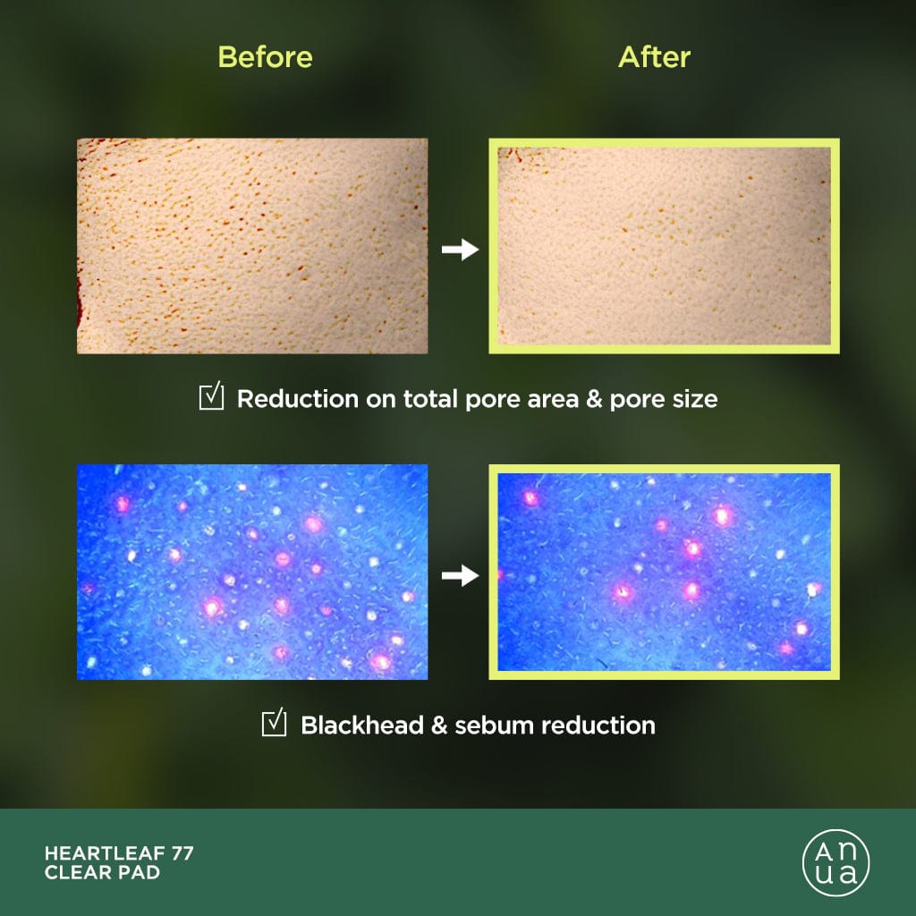 HEARTLEAF 77% TONER PAD | ANUA تونر الوسائد المبلولة من انوا