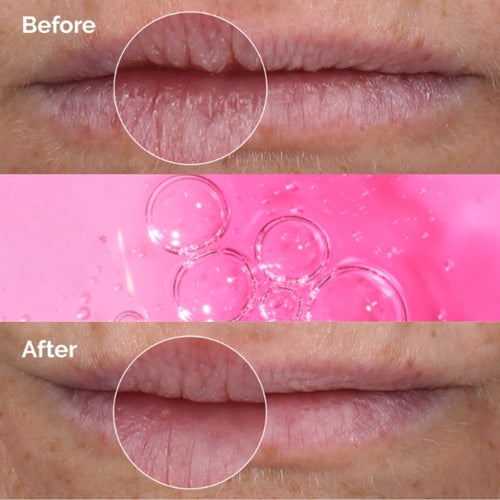 The Ordinary PHA 5% Exfoliating Lip Serum
