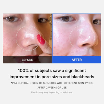 Medicube Zero Pore Pad (70)