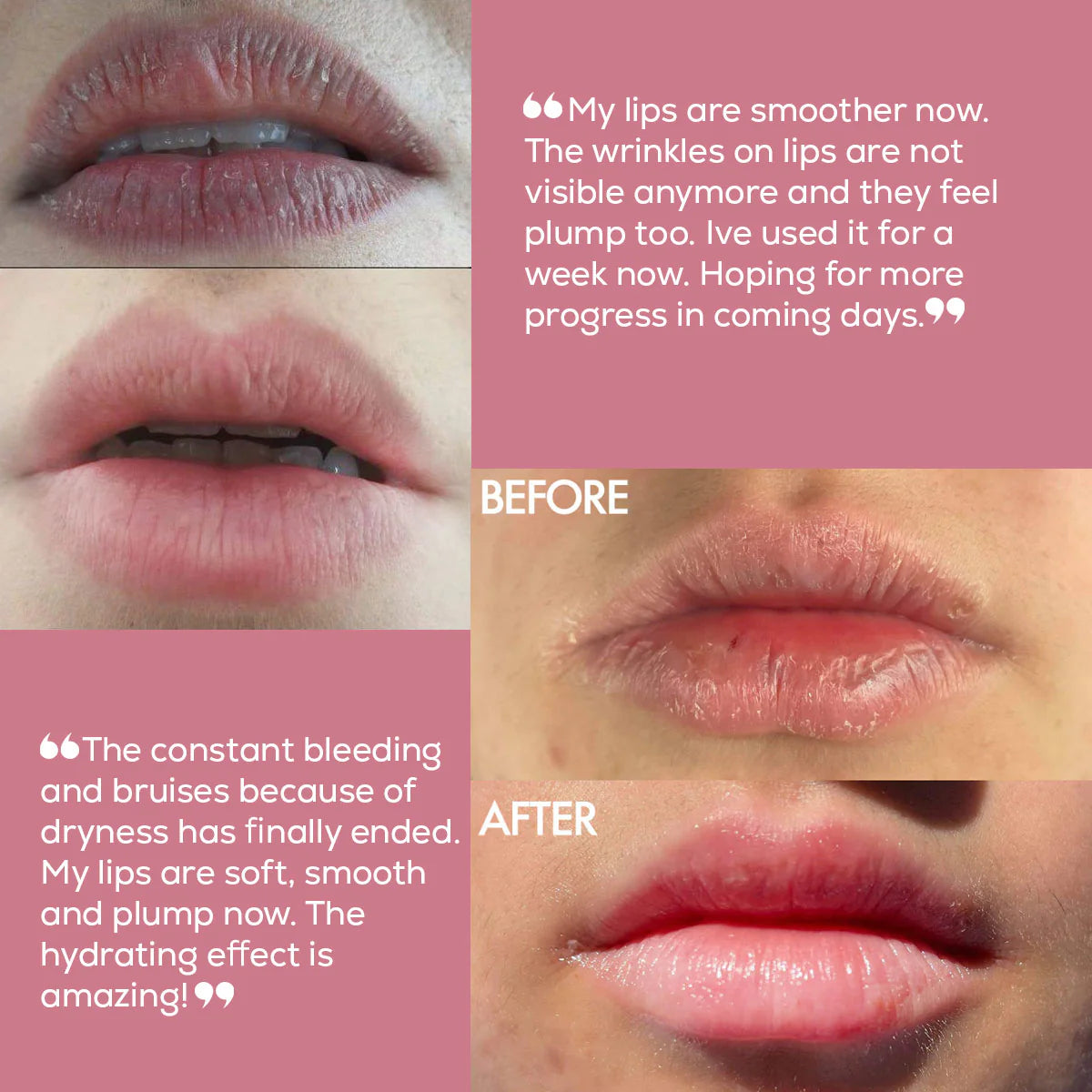 Long 4Lashes lip volume filler ملمع ومكبر شفاه