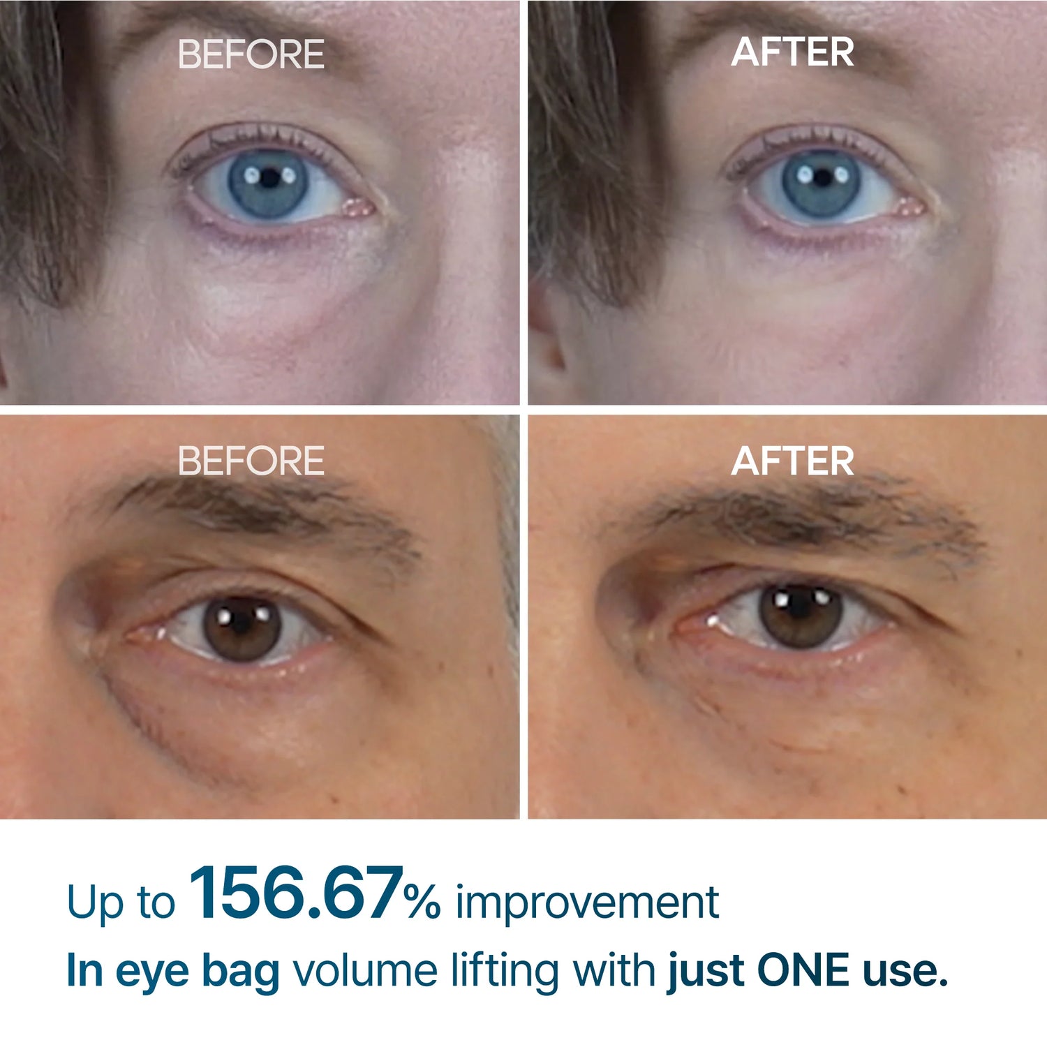 Dr. Melaxin Eyephalt eyebag cream