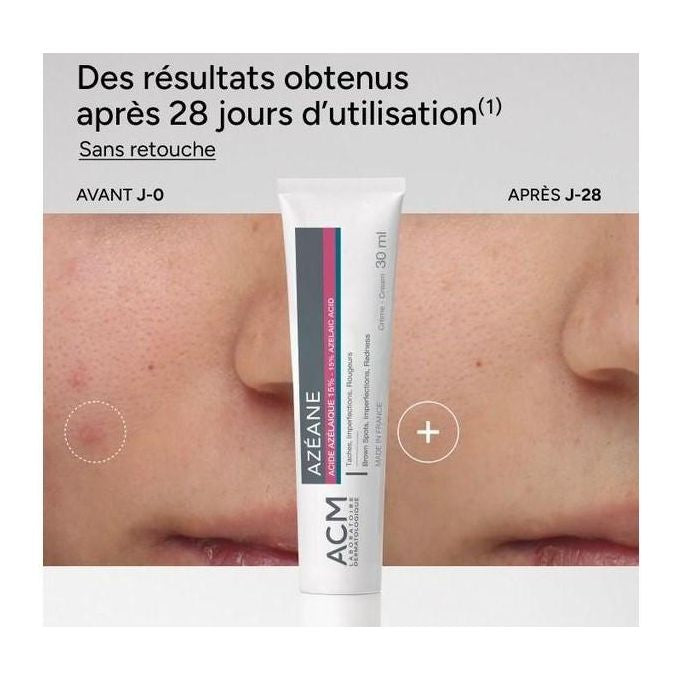 ACM Azéane Azelaic Acid 15% Cream 30 ml