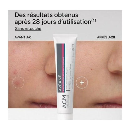 ACM Azéane Azelaic Acid 15% Cream 30 ml