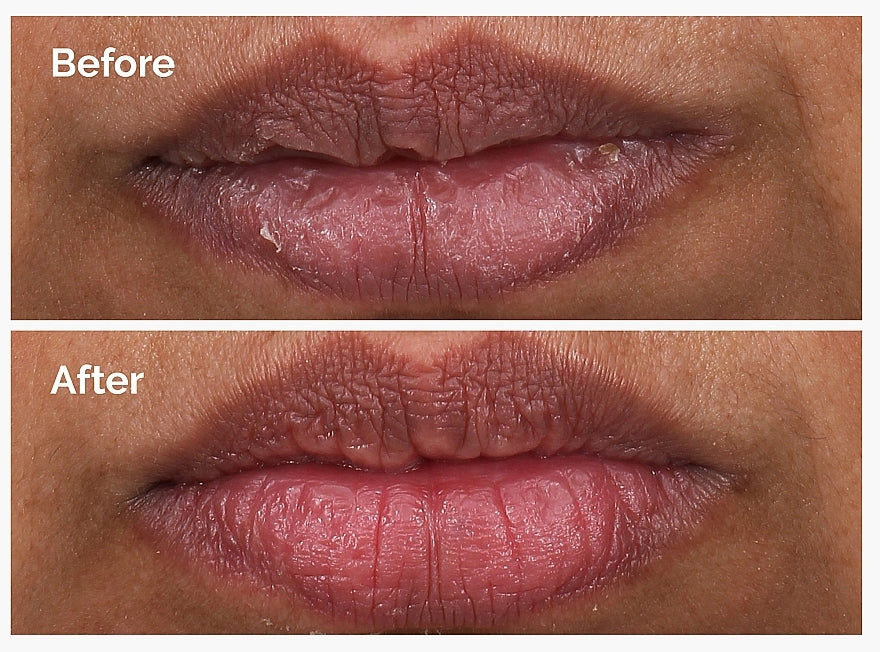 The Ordinary PHA 5% Exfoliating Lip Serum