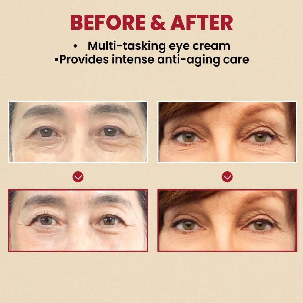 SEOUL 1988 RETINAL - (Eye+Face) ريتينال الوجه والعيون من سيول