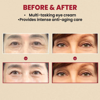 SEOUL 1988 RETINAL - (Eye+Face) ريتينال الوجه والعيون من سيول