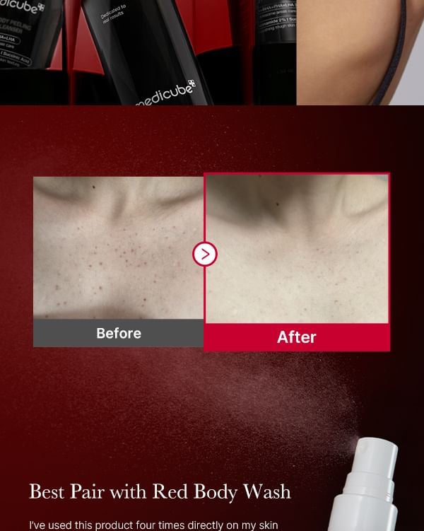 Medicube Red Body Peeling Shot 110ml تقشير الجسم الأحمر من ميديكوب