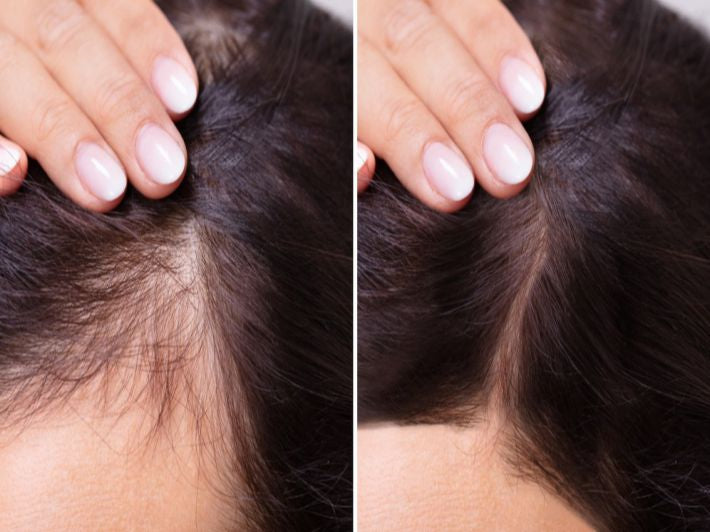 Some By Mi Cica Peptide Derma Anti Hair Loss Kit