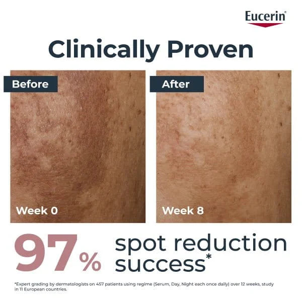 Eucerin Anti-Pigment Dual Serum